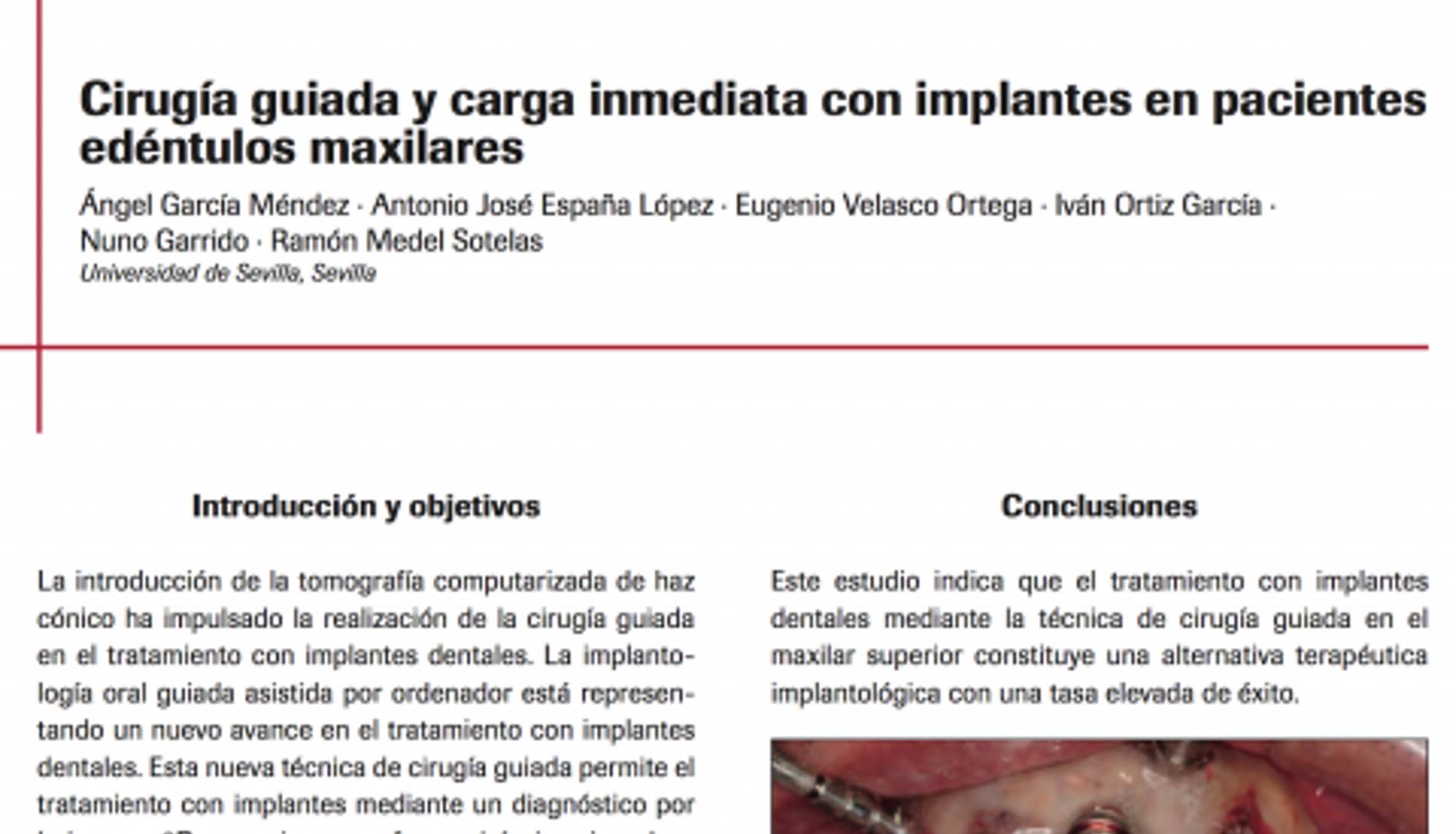 Implantes em pacientes edentulos