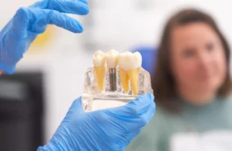 O que é um Implante Dentário e Como Funciona