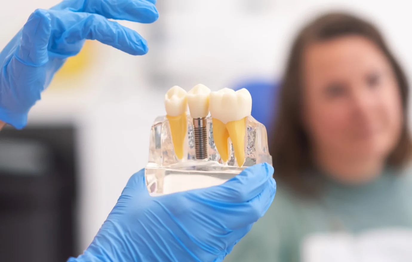 closeup-dental-model-with-implant-patient-dental-clinic-blurred-background-dentistry