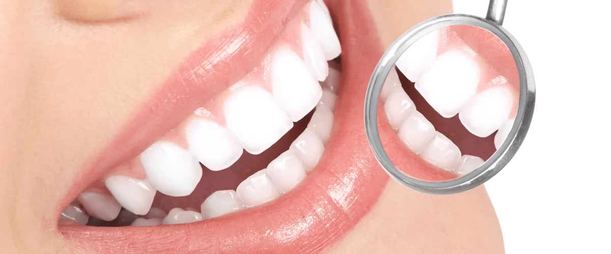 Healthy and aligned teeth after orthodontic treatment of medical excellence
