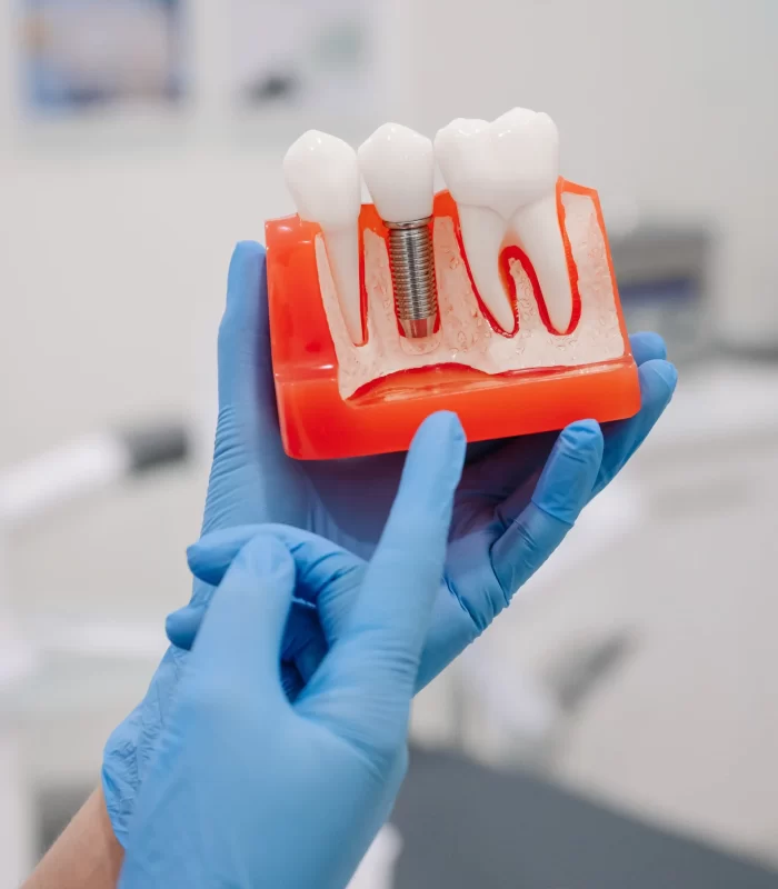 closeup-female-hand-holding-dental-mold